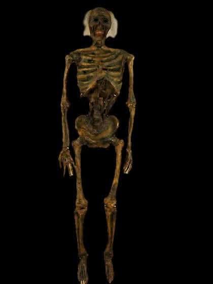 Life- Size Rotted Skeleton