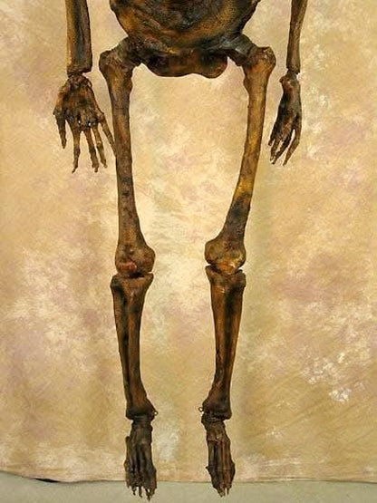  Life- Size Rotted Skeleton