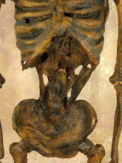  Life- Size Rotted Skeleton